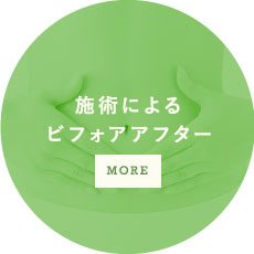 施術によるビフォアアフターMORE